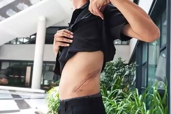 Kisah Ifan, Jual Ginjal Untuk Beli HP, Televisi dan PlayStation. Apa yang Terjadi&nbsp;Kemudian?